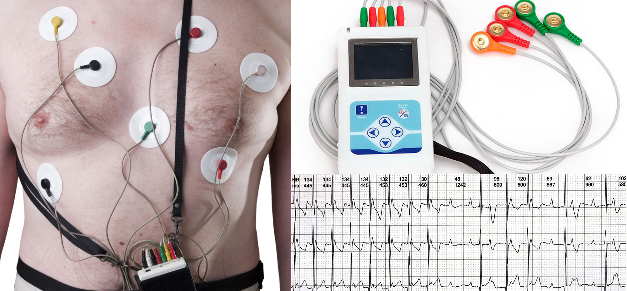 holter cardiaco